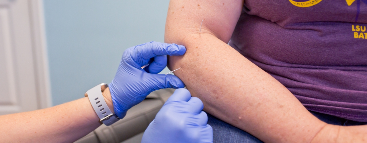 Dry-needling-River-Ridge-Chiropractic-River-Ridge-LA