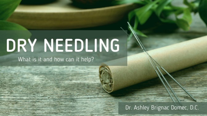 Dry Needling: Can it help you?